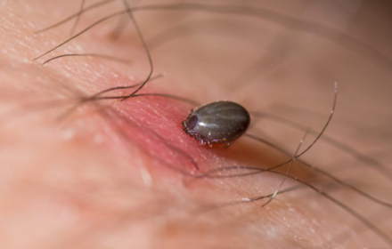 Gratis informatieavond over tekenbeten en Lyme in Nieuw-Vossemeer