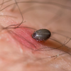 Gratis informatieavond over tekenbeten en Lyme in Nieuw-Vossemeer